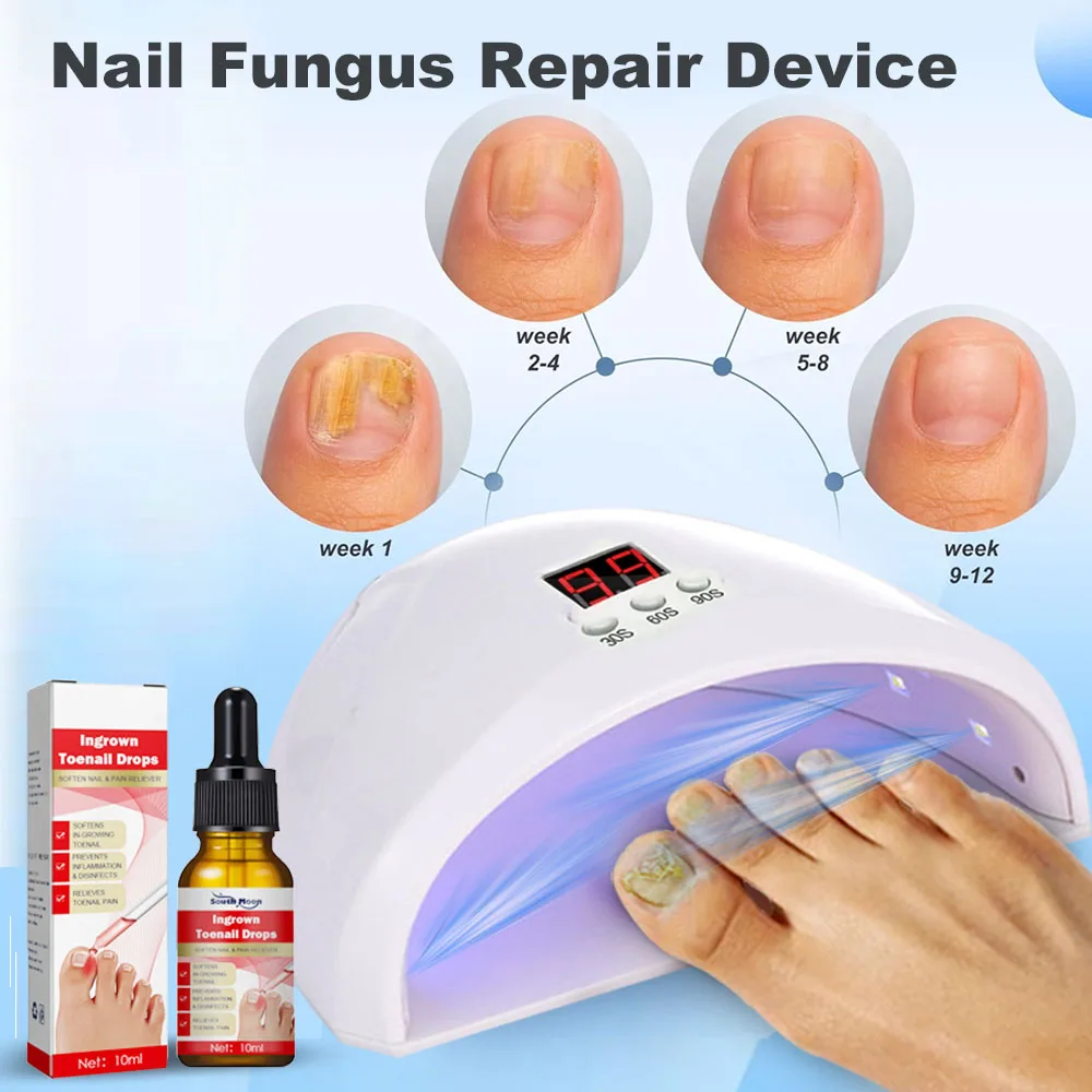 Nail Fungal  Laser Treatment Device Repair Anti Infection Paronychia Onychomycosis Ingrown Toenail Foot Care Essence