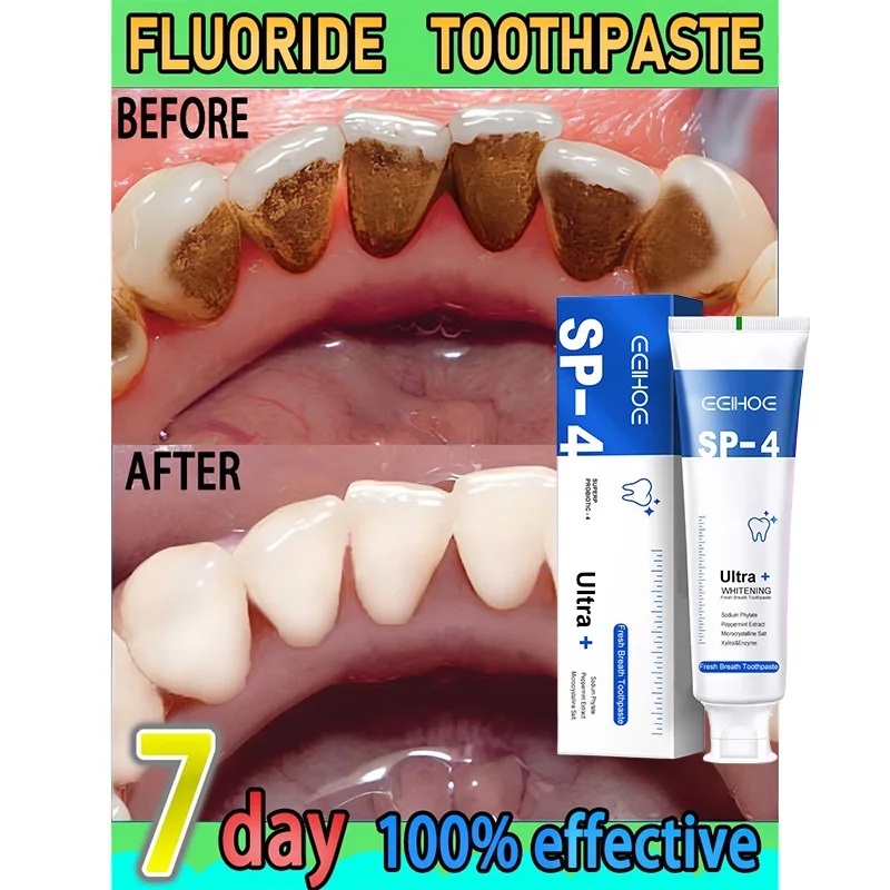 Probiotic Toothpaste SP-4 Whitening Tooth Remove Bad Breath Plaque Stains Teeth Whitener Oral Hygiene Care Clean Fresh Breath