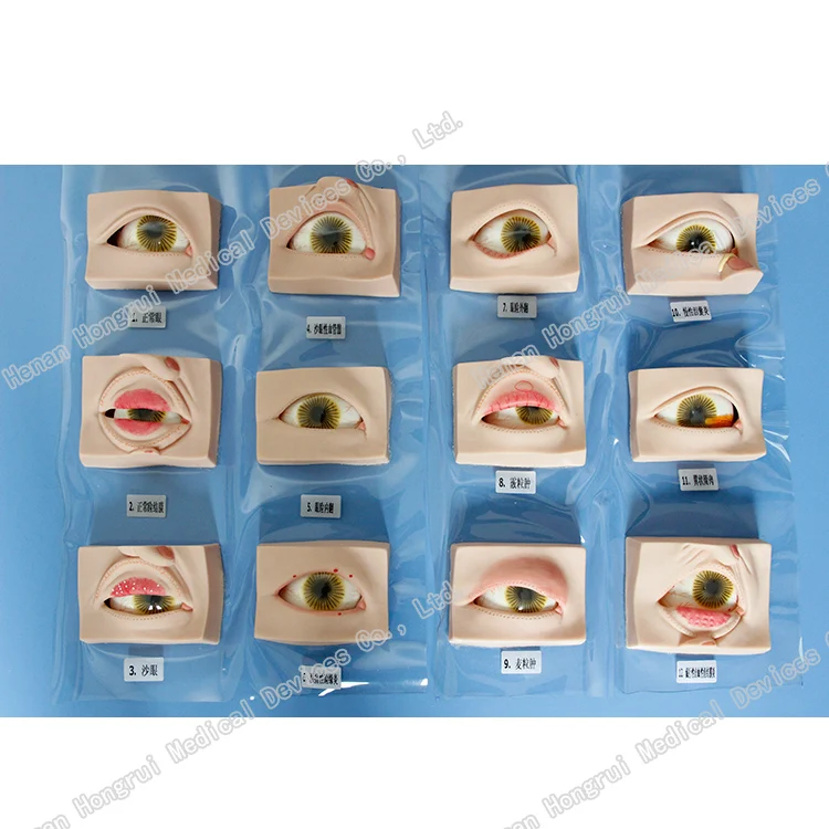 

Human Oculopathy Anatomical Model, Medical Eye Models, Eye Disease Model