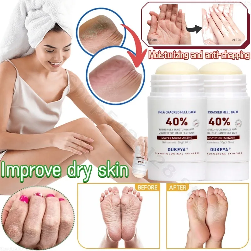 Urea Cream Anti-crack Frostbite Cream Cracked Heels Repair Cream Foot Exfoliation Dead Skin Cleaning Repair 30g