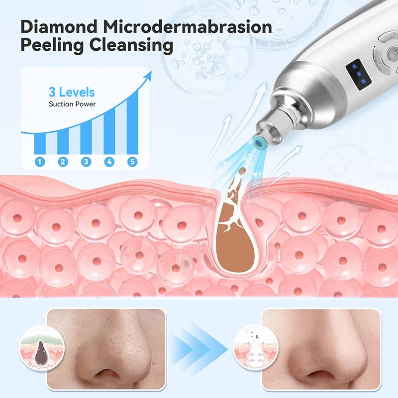Upgraded Diamond Microdermabrasion Machine Blackhead Removal Professional Facial Deep Cleasing Device Home Use Facial Skin Care 3