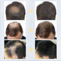 Poudre épaississante à la kératine pour fibres capillaires, 27.5g, Spray pour fibres de renforcement des cheveux, poudre de repousse instantanée, perte de cheveux, dissimule le produit capillaire 6