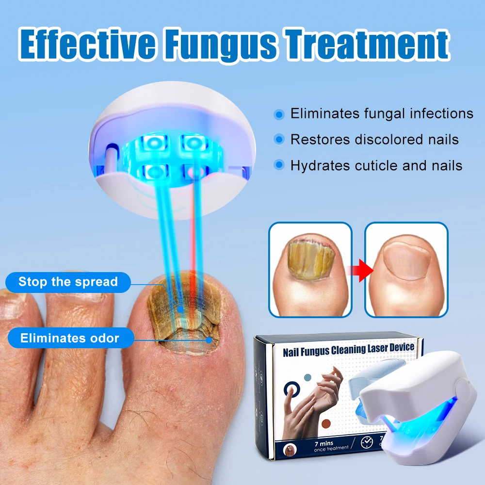 Nail Fungus Remover Nail Fungus Laser Treatment Device Repair Toenail Fingernail Fungus Treat Onychomycosis Laser Nails with Mushrooms Relaxation Laser Therapy Pen