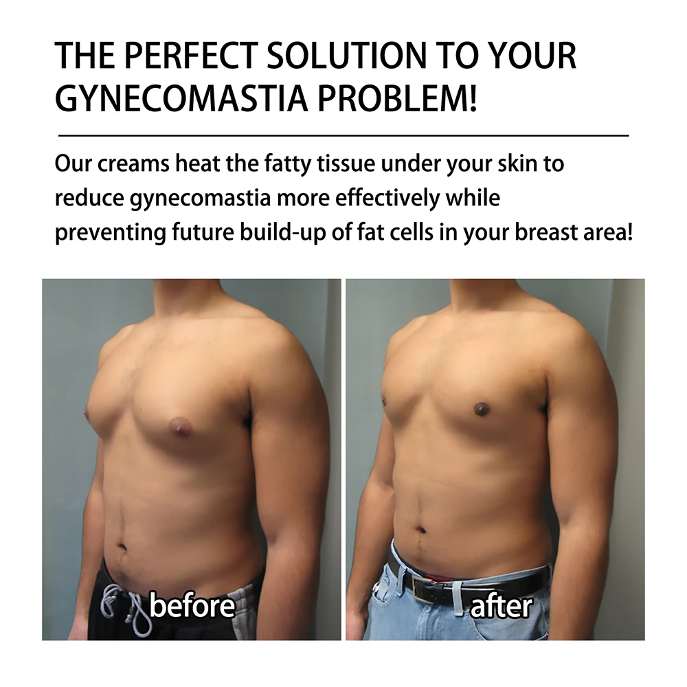 Breast Enlargement Cream Weight Loss Cream Man Breast Firm Massage Ginger Serum Remove Excess Fat Shrink Chest Gynecomastia Tighten 30ml