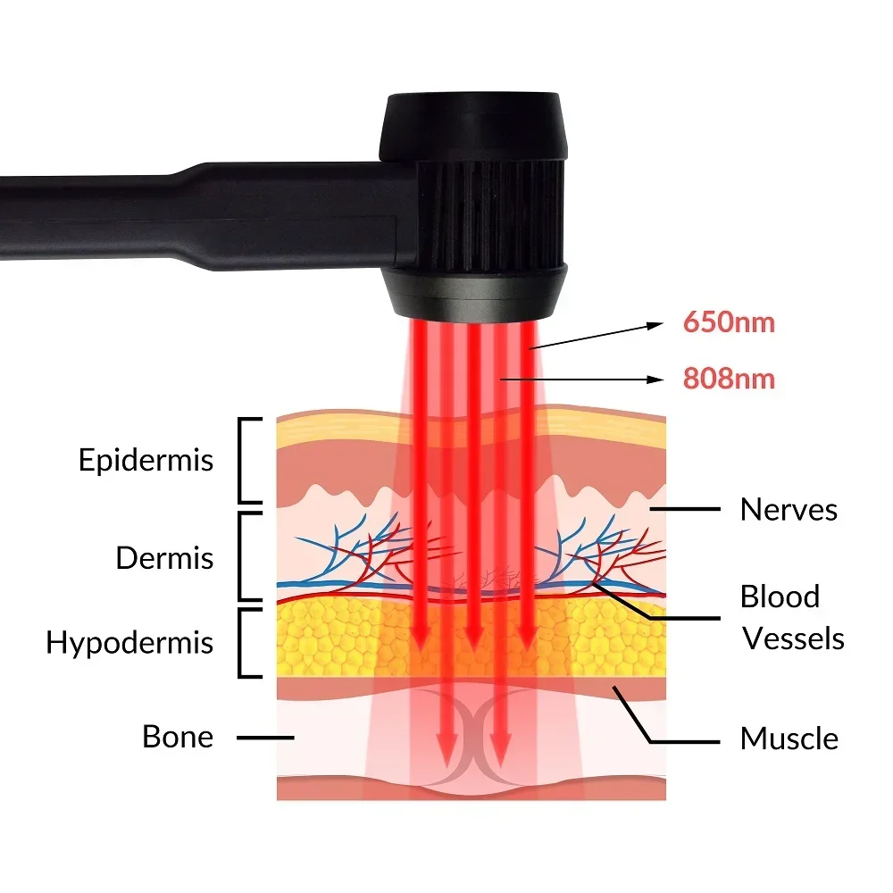 5000mW 10X650nm 15X808nm Professional MLS Cold Laser Low Level Laser Therapy Medical Care Equipment for Horses Dogs Cats Pain