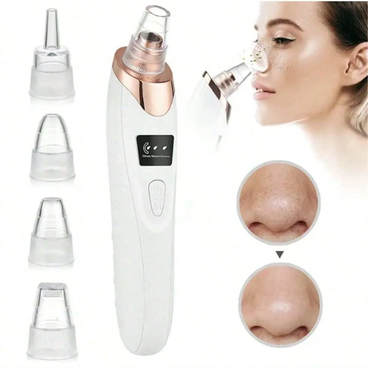 USB Rechargeable Blackhead Remover Pore Vacuum
