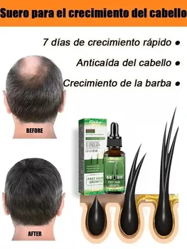 Hot selling product, 99% of buyers buy again, have more and more hair, say goodbye to baldness, thick hair