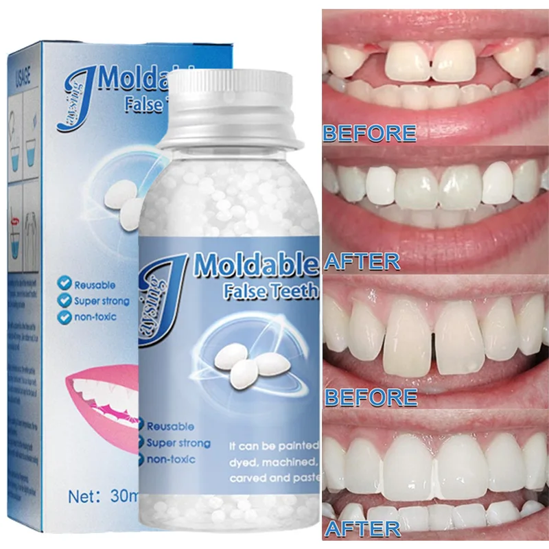 102030mlTemporaryToothRepairKitTeethandGapsFalseTeethSolid