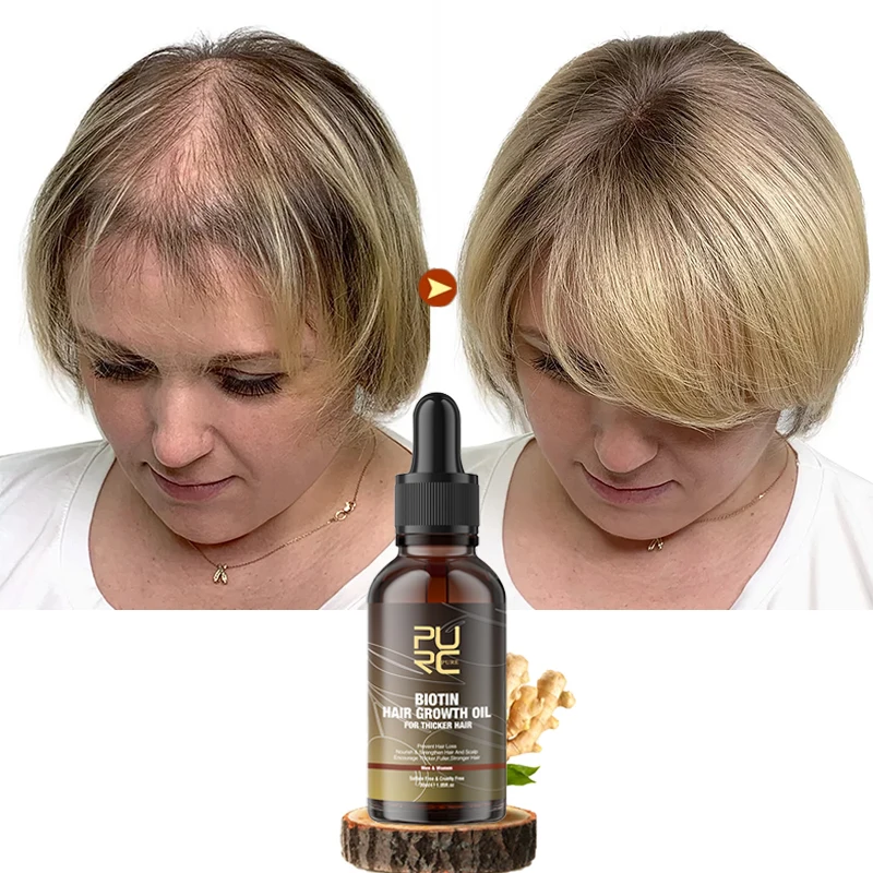 

PURC Biotin Hair Growth Oil for Men Women Ginger Anti Hair Loss Care Scalp Treatment Beard Grow Oils Hair Regrowth Products