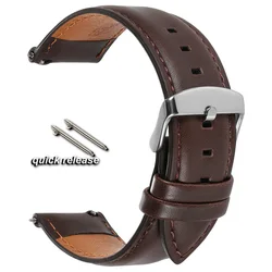 Elegant Genuine Cowhide Leather Watch Straps - Retro Black, Brown, Red, Blue - 18mm (Dark Brown)
