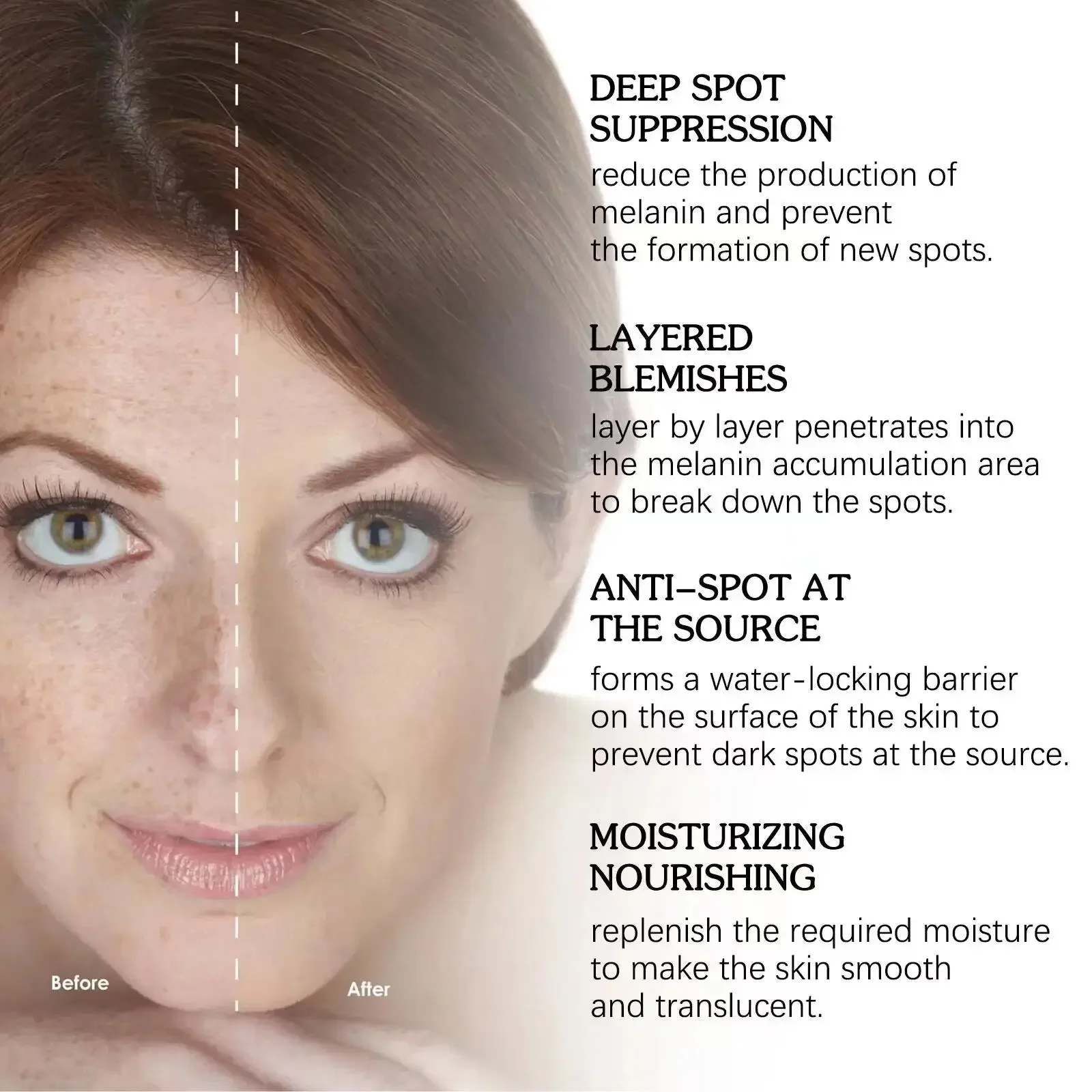 Powerful Dark Spots Remover Freckle Whitening Serum Melanin Correcting Anti Pigmentation Brighten Korean Day Night Facial Care 4