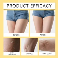 Crème raffermissante pour le corps au venin d'abeille, Lotion Anti-âge et raffermissante pour la peau crapée, traitement hydratant et contour pour femmes 5