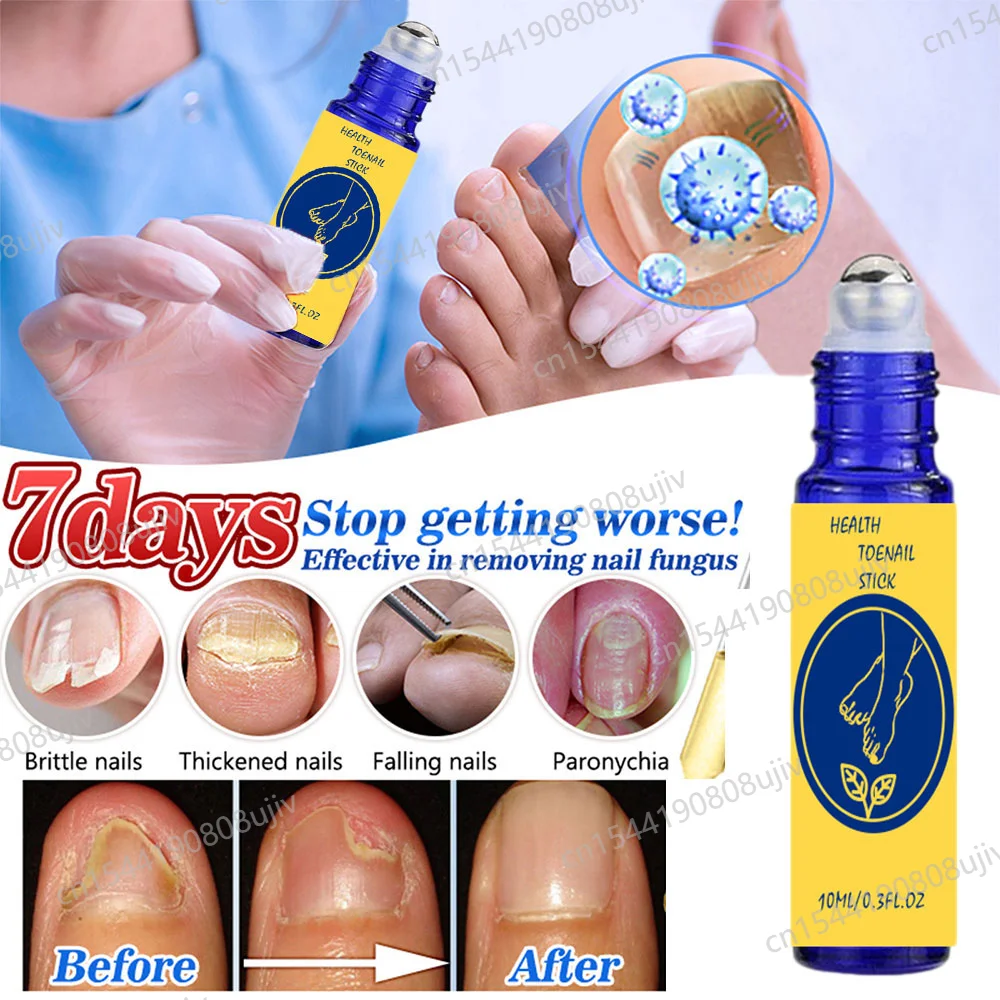 Professional Nail Tools For Nails Care And Repair Inhibiting Fungi To Solve Onychomycosis And Paronychia