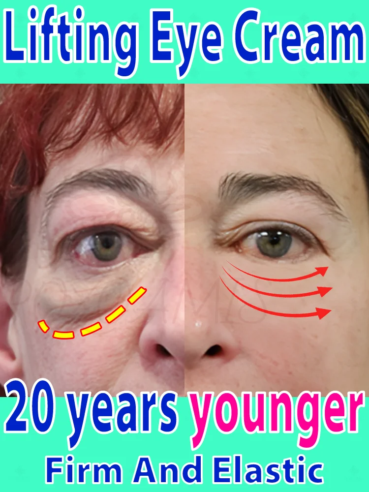 Lifting eye cream unlock eye firmness and regain youthful confidence