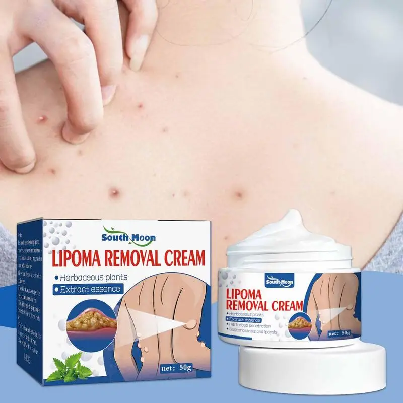 Lipoma Removal Cream The Whole Body Multiple Subcutaneous Conditioning Cream Eliminate Paste Fiber Paste Skin Care 50g