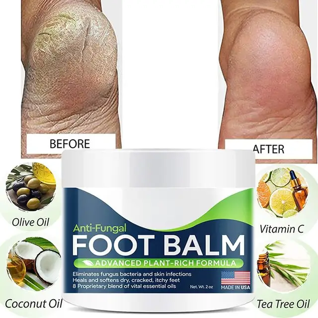 All-Natural Plant Foot Balm: A Moisturizing Foot Care Cream for Dry Skin