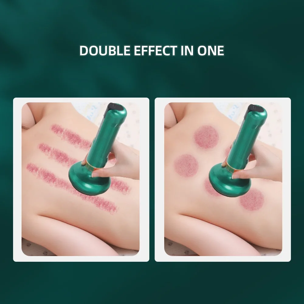 Electric Vacuum Cupping Massager Body Guasha Scraping Massager Fat Burning Slimming Physiotherapy Hot Compress Fatigue Relief