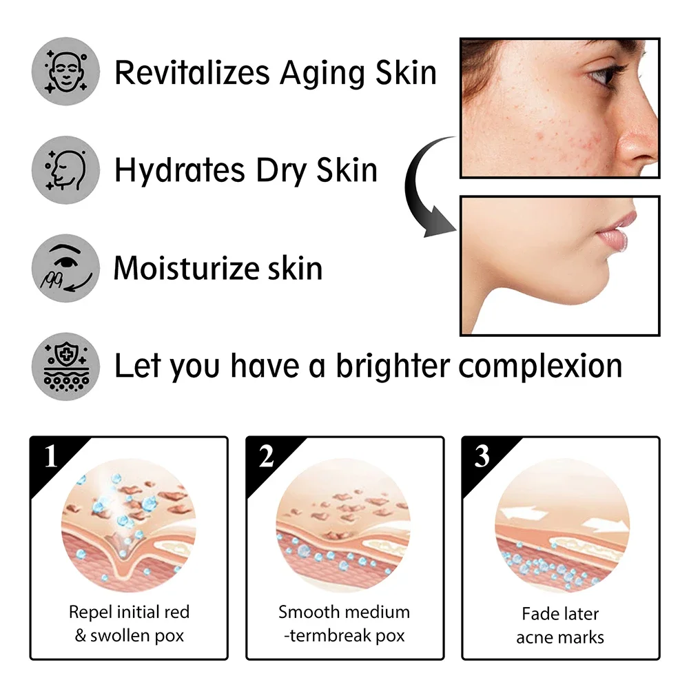 Hyaluronic Face Moisturizer Moisturizing snail Cream Anti-Wrinkle Aging Moisturizing Shrink Pores Whitening Smooth Skin Care 3