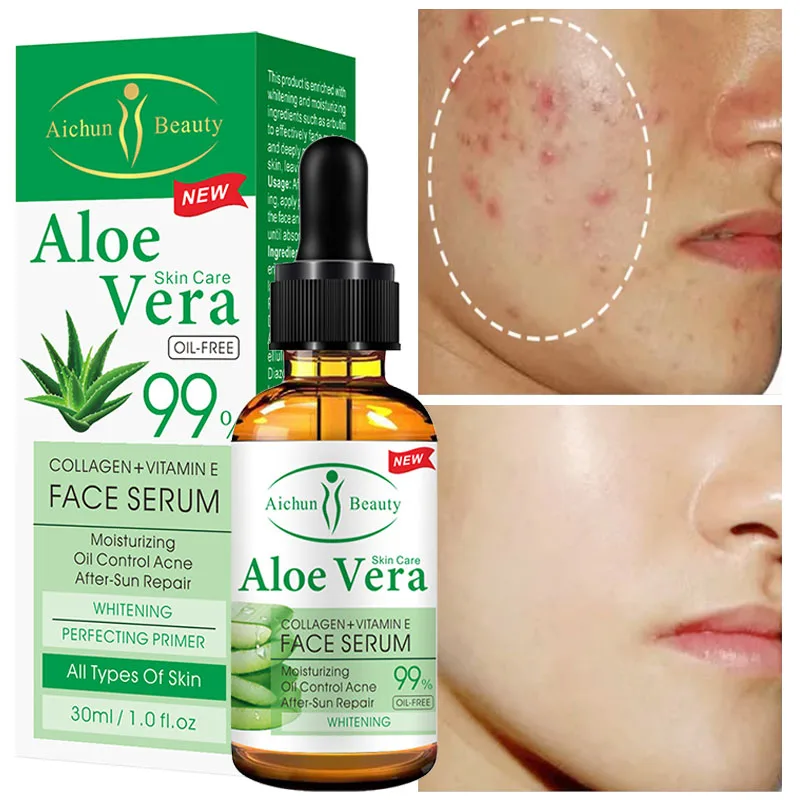 

Aloe Vera Face Serum Oil Control After Sun Repair Moisturizing Facial Serum Pore Shrink Acne Treatment Anti Aging Skin Care