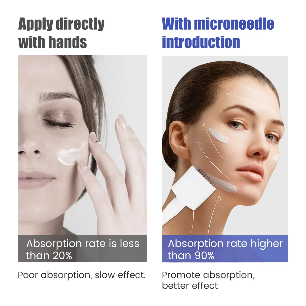 Derma Stamp Microneedling Face Roller Massager Adjustable Titanium Needle Length Skincare Beard Growth Scalp Hair 100/140A