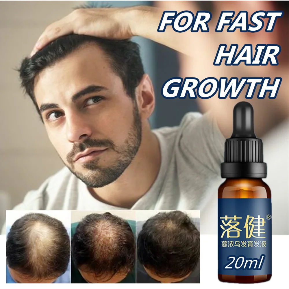 Fast Hair Growth Essence Liquid Hair Regeneration Serum Antihair Loss