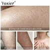 Keratosis Pilaris Repair Cream Vitamin E Skin Care Moisturizing Remove Hard Lumps Dry Rough Adjust Skin Tone Tighten Skin 50g 2