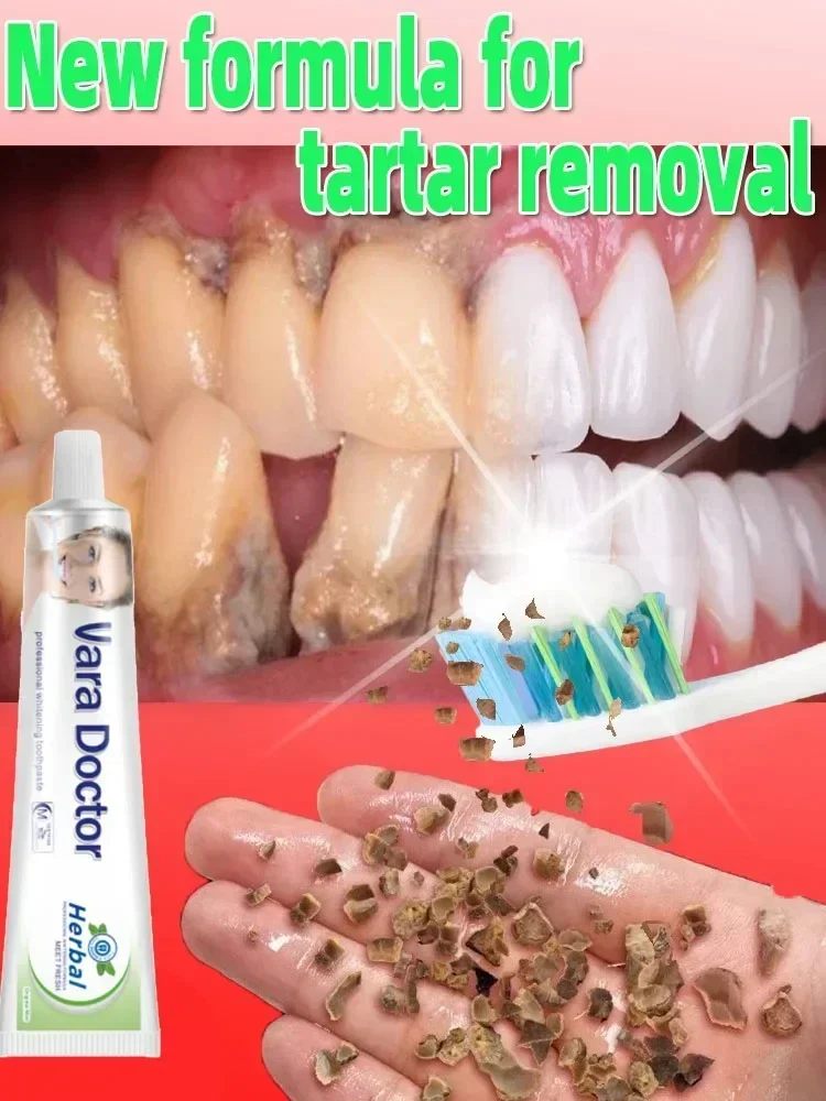 Whitening Toothpaste Dental Calculus Remover Mouth Odor Bad Breath Preventing Periodontitis Oral Care Product teeth whitening product teeth whitening essence dental calculus remover teeth health product