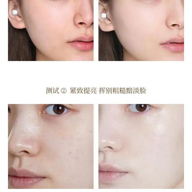 No Needle Face Filler Thread Anti Aging Lifting Face Line Carved Protein Skin Absored Lines Wrinkle Remove Essence Peptide Serum 6