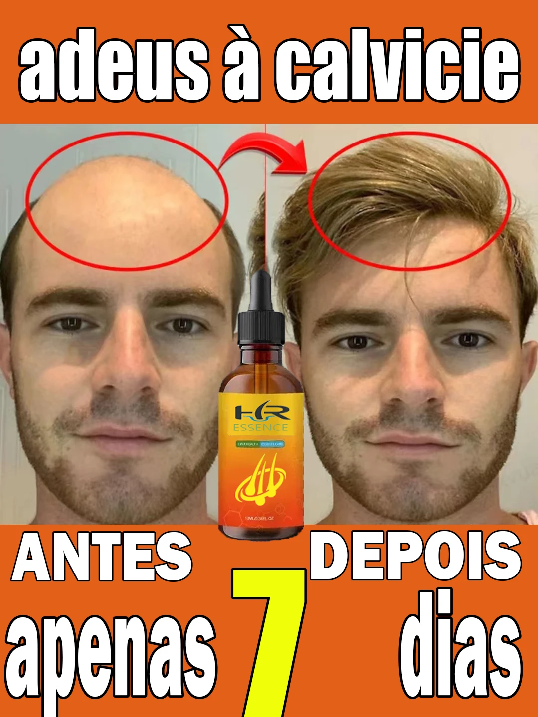 El cabello,que promueve el crecimiento del cabello largo,puede crecer en cualquier lugar y ayudar a evitar lap&eacute;rdida de cabello.