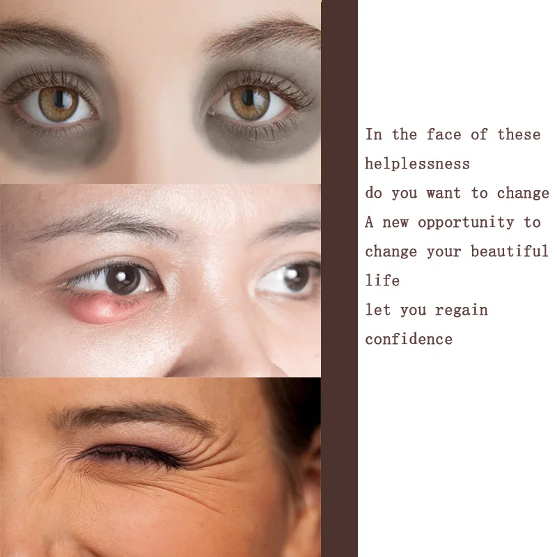 Wrinkle Eyes Face Cream Anti Dark Circle Eye Firming Anti Aging Moisturizer Facial Cream Remove Fineline Skin Care Beauty Health_voghion.com