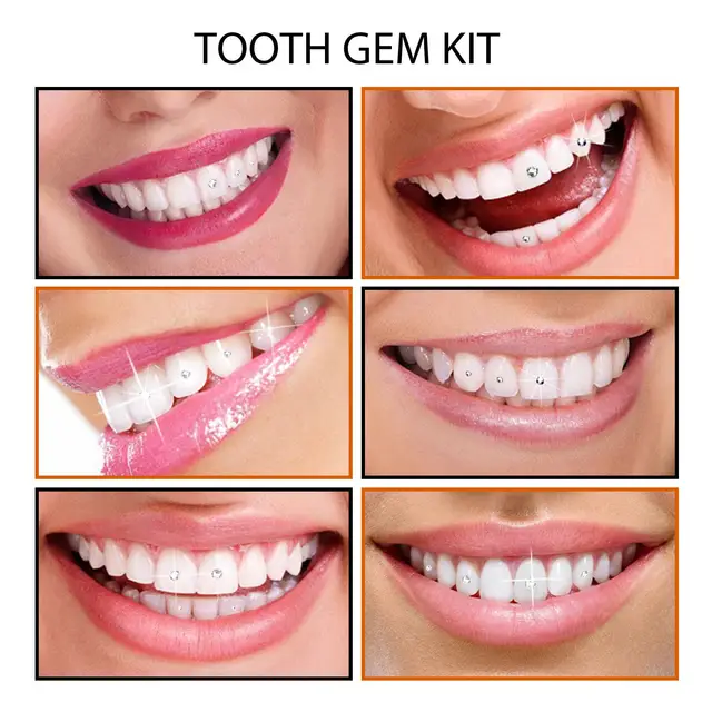 Tooth Gem Kit With Uv Curing Light Resin Glue Gem Suit Gems - Temu Saudi  Arabia