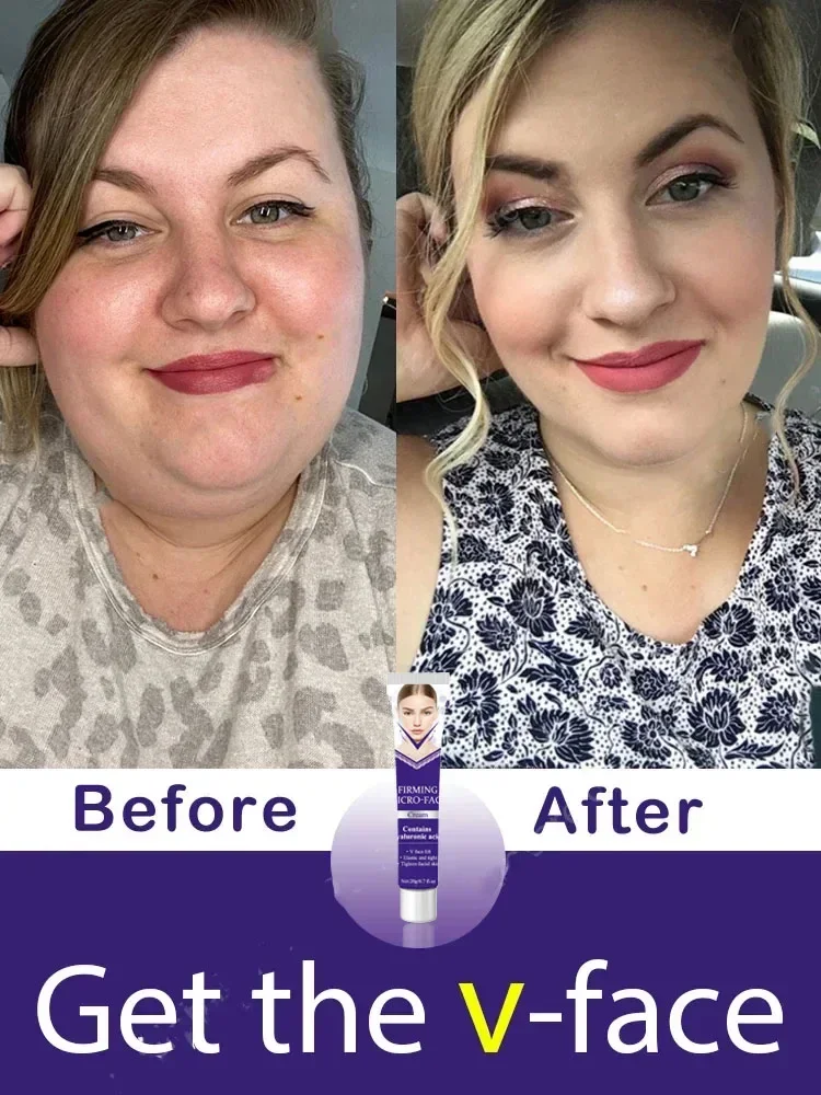 Skinny Face Cream V Series Double Chin Remover