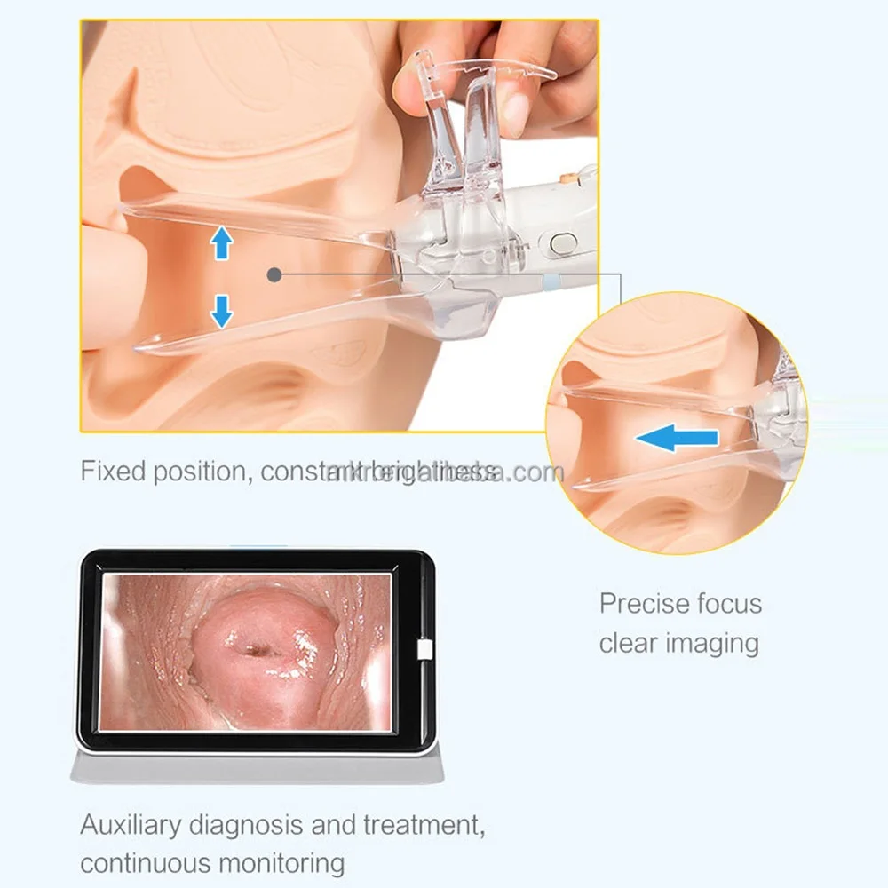 Mini Colposcope with Digital Video for Accurate Link PC Monitoring Health Monitors Accesorios Medicos Selectable Add Pad
