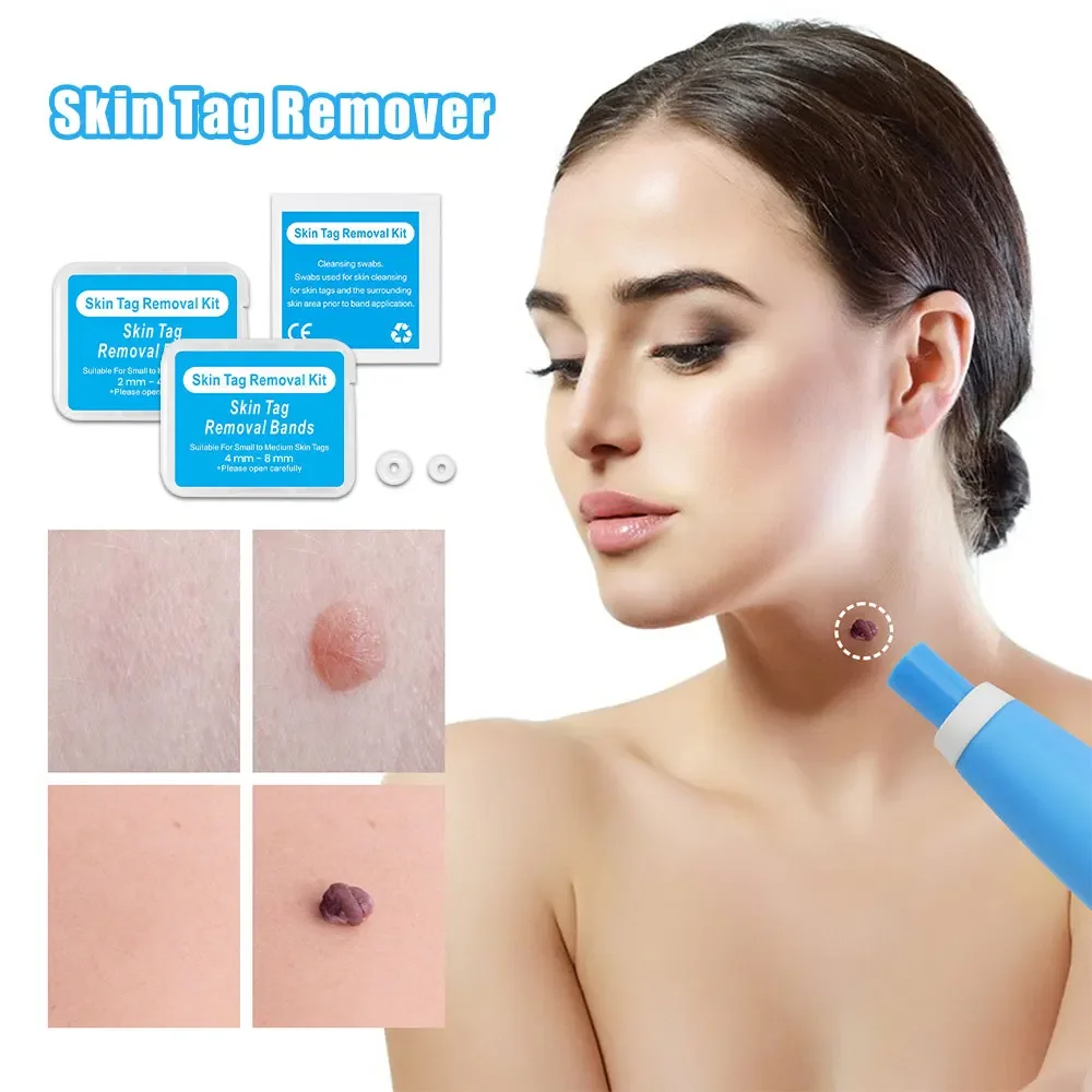 Auto Micro Skin Tag Remover Device 2 in 1 For Adult Mole Wart Remover