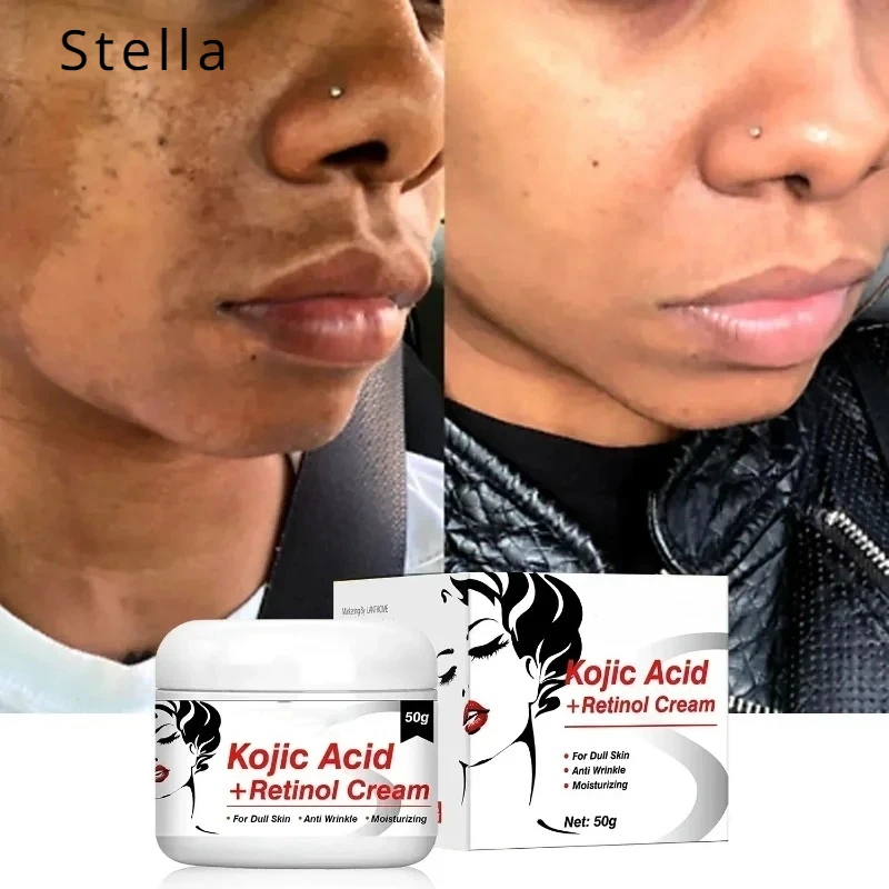 Retinol Cream Women's Melasma Kojic Acid Cream Improves Dull Yellow Reduces Dark Skin Production Hydrating Facial Skin Care