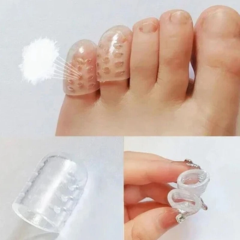 

10 шт., силиконовые протекторы для вросших ног