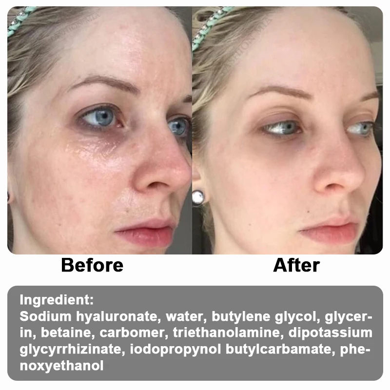 Hyaluronic Acid Serum 10ml Cross-linked HA Original Solution Ultrafine Molecules Hyaluronic Acid Ampoule Facial Moisturizing Anti Wrinkle Anti-aging