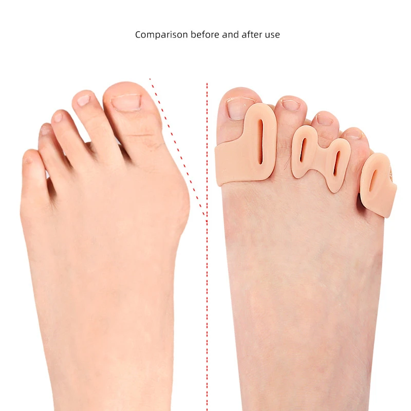 4pieces=2pairs Gel Hammer Toe Corrector Splitter Foot Care Silicone Bunion Pain Relieve Orthosis Hallux Valgus Protector Pads