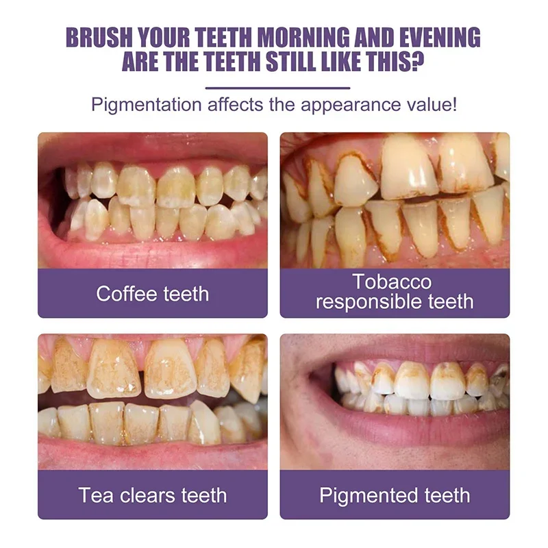 Teeth whitening tooth powder effective remove plaque stains dental calculus fresh bad breath oral hygiene care product