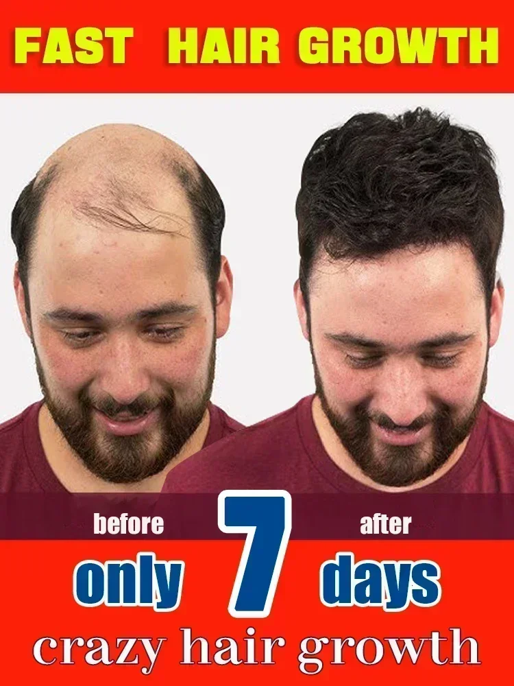 Hair Thickening Product Have More Hair Say Goodbye to Baldness Thick Hair