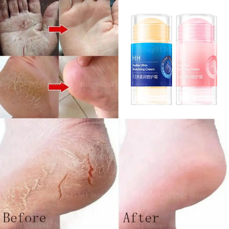 2Pcs Vaseline Moisturizing Cream Anti-Dry Cracked Foot Hand Cream Smooth Wrinkle Multi Balm Stick Removal Dead Skin Feet Care