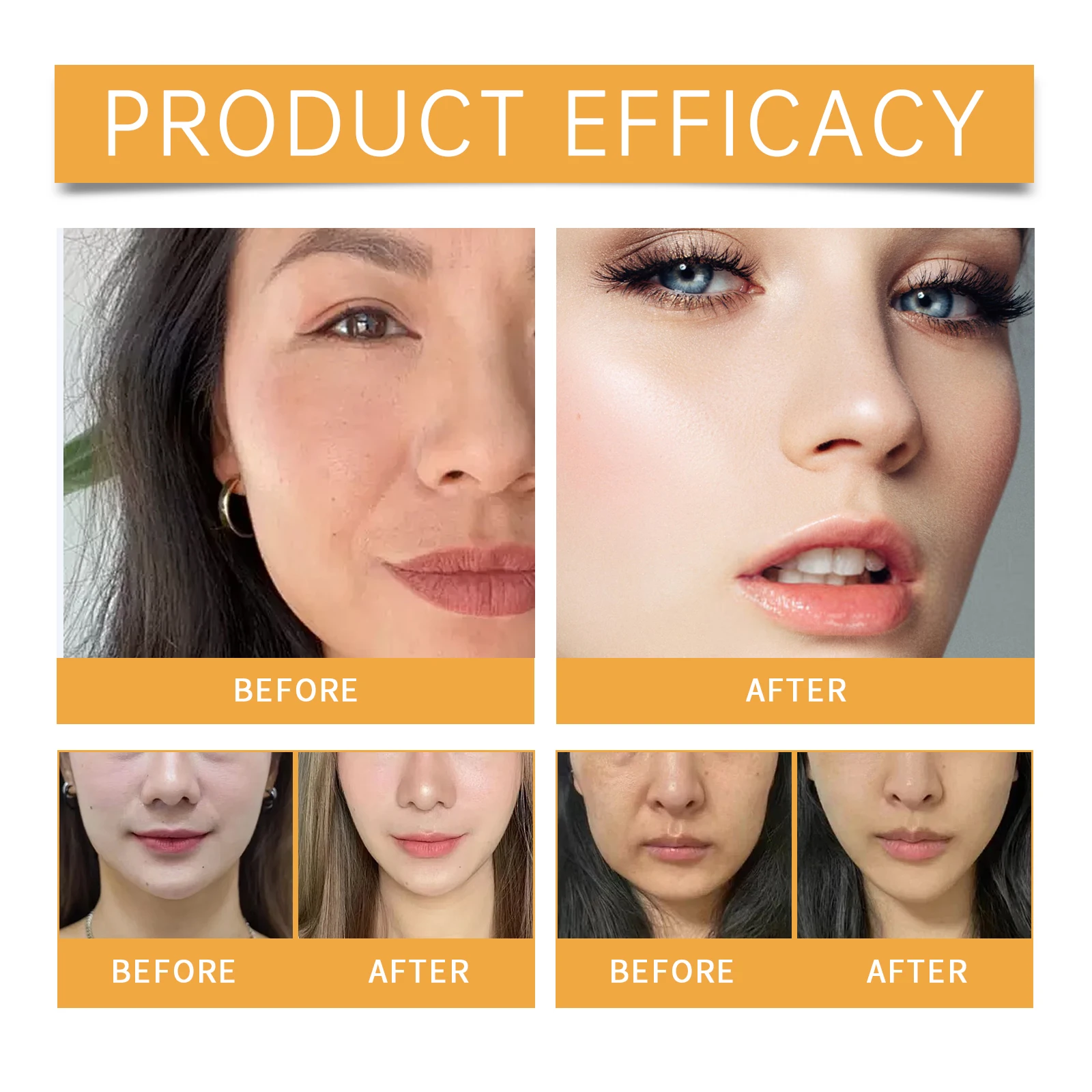 Nasolabial Anti-Wrinkle Patches 2