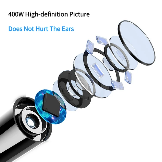 Xiaomi Intelligens Vizuális Fülpálcák Endoszkóp 400W Nagy Pontosságú Füldugó Mini Kamera Otoscope Health Care Fül Tisztító Tiszta Szerszám - Image 3