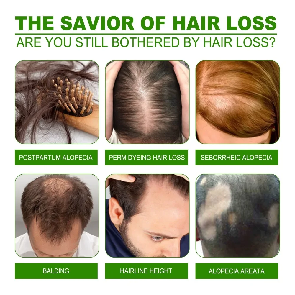 Hair Care Lotion 120 ml Hair Regrowth Treatment Growth Strengthens Damaged Loss Revitalizes Scalp For Men & Women