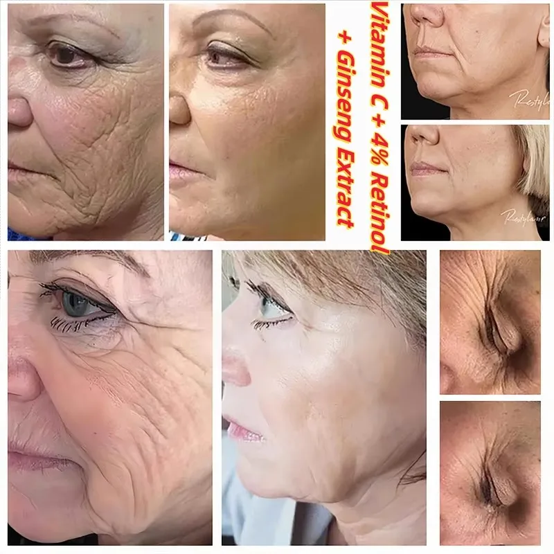 سيول 1988 فيتامين C العناية بالتجاعيد 4% ريتينول ا...