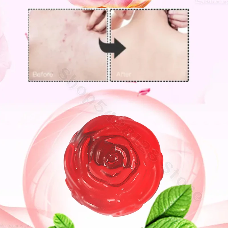 Effectively Remove Mites Cleanse Control Oil Clean Skin Remove Blackheads and Use Rose Essential Oil Soap All Over Your Body 80g