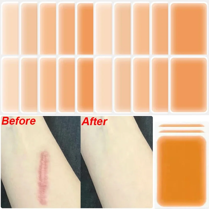 Waterproof Temporary Tattoo Concealer Stickers for Acne Scar Cover