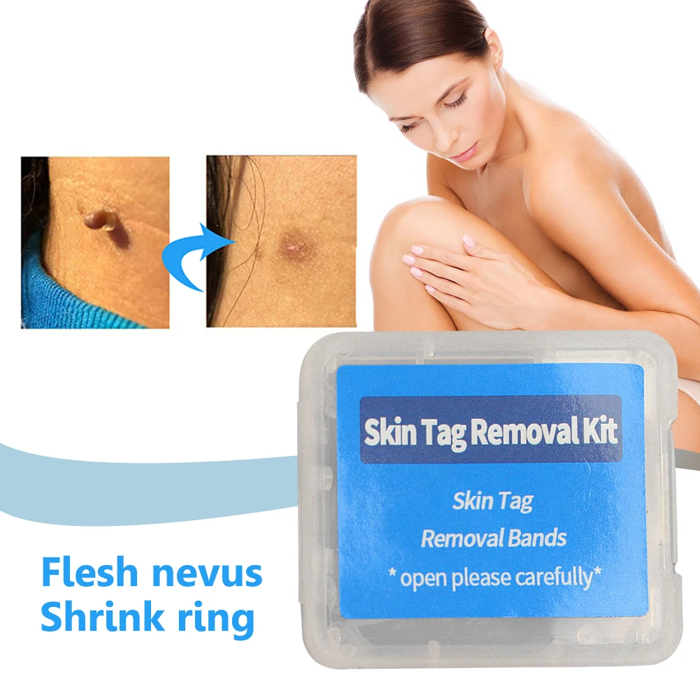 Warts Acne Pimple Treatment Kits 3