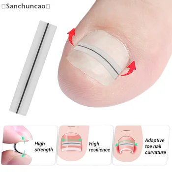 Strumento per la correzione dell'unghia del piede incarnita Raddrizzamento Clip Brace Trattamento delle unghie dei piedi incarnite Adesivo patch elastico Strumento per pedicure 1