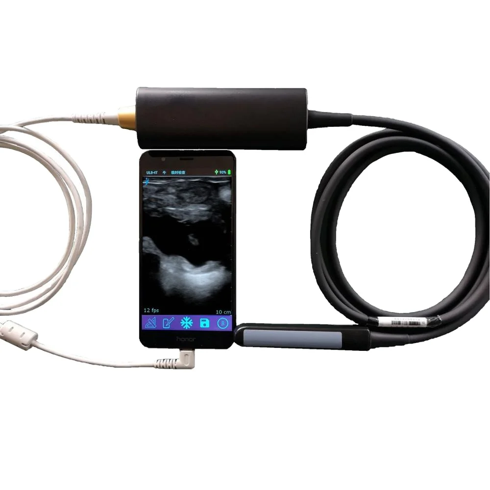 

Veterinary Ultrasound Probe with Android/IOS/Windows System